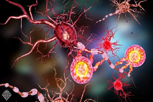 Multiple Sclerosis Treatment