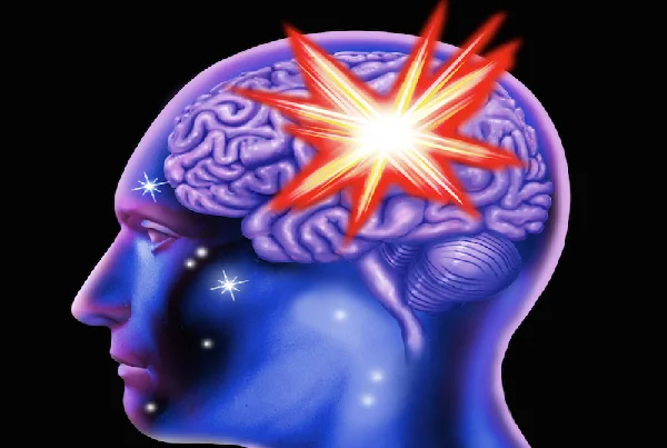 Brain Haemorrhage Treatment