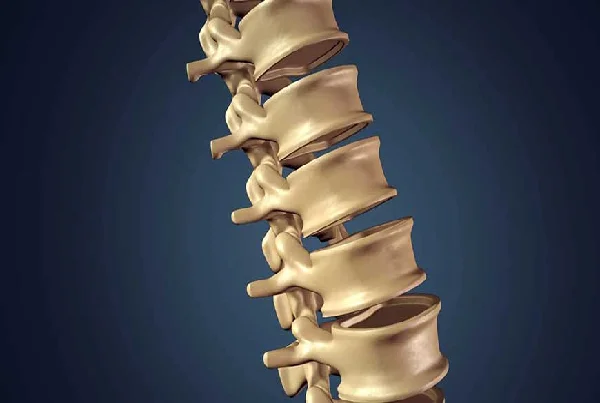 Spine Fixation